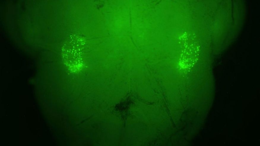 On each side of the brain stem, a florescent-green marker illuminates the 200 neurons that control the sighing reflex.